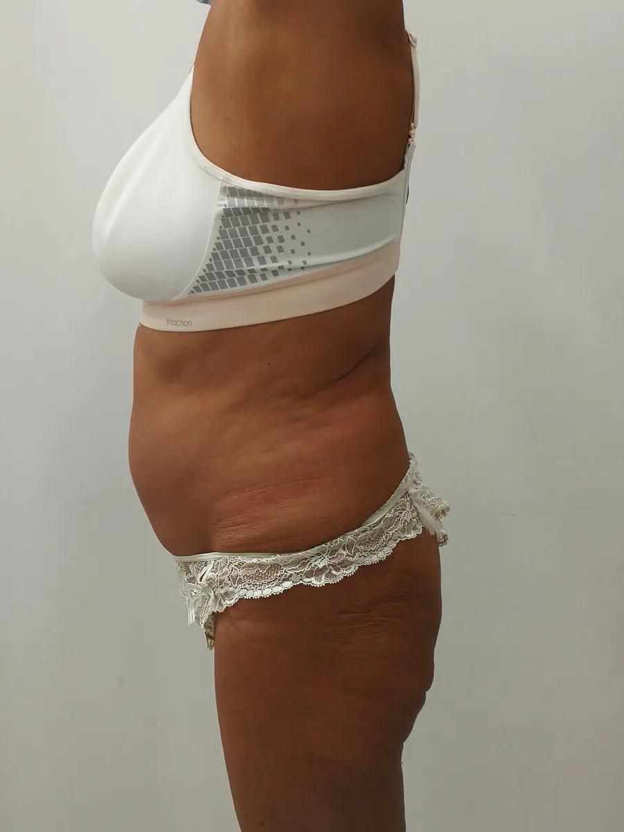 Profilo del corpo dopo il percorso personalizzato