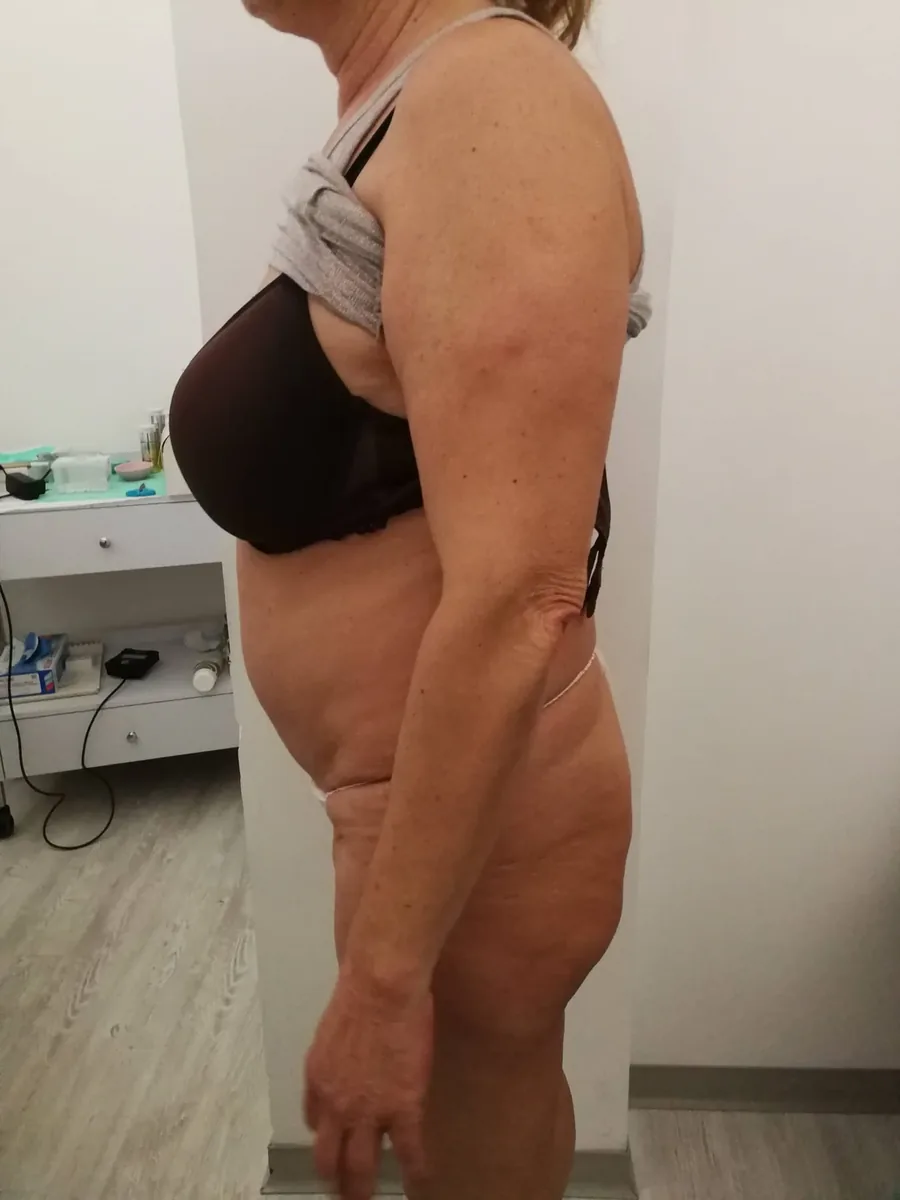Profilo del corpo prima del percorso personalizzato