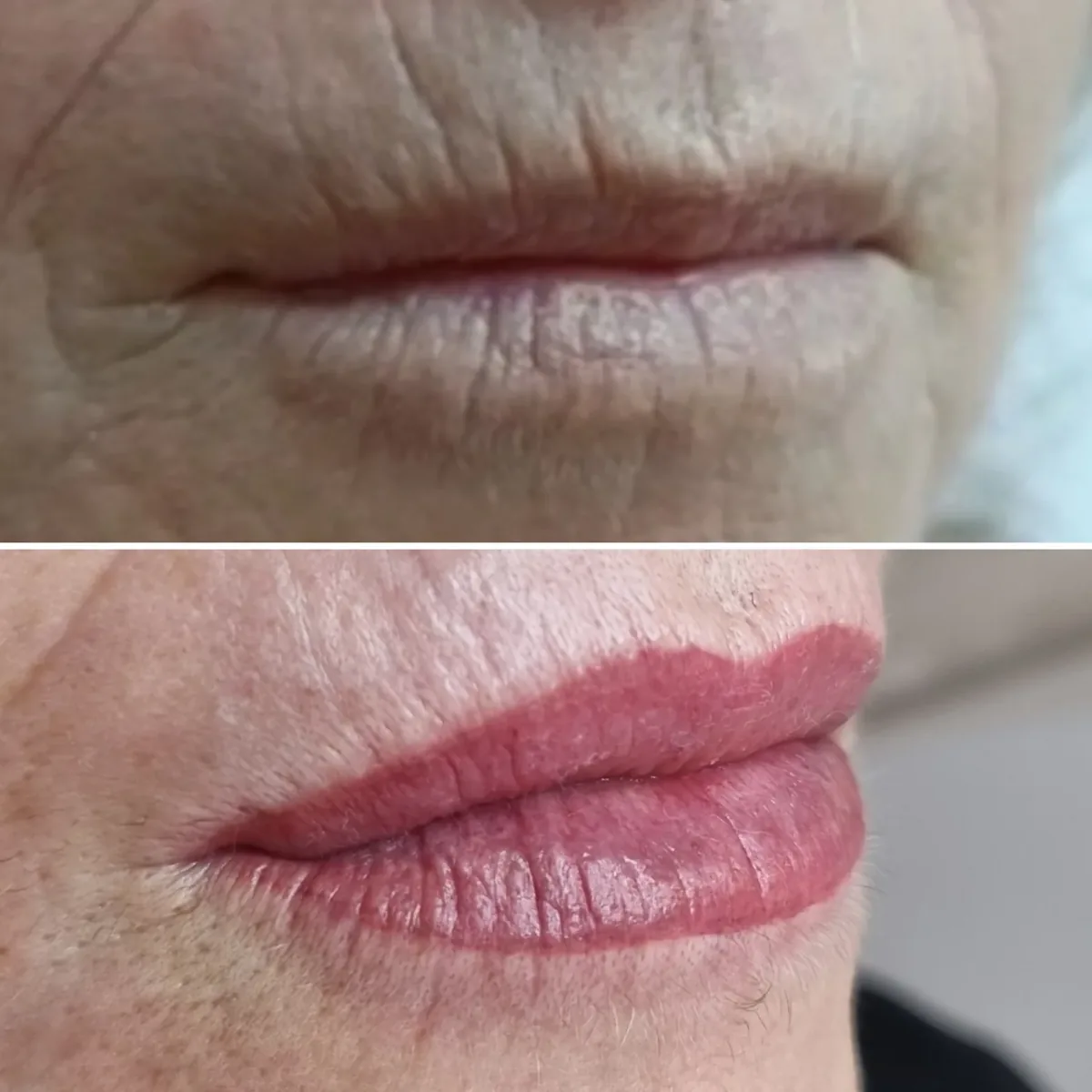 Labbra prima e dopo la ripigmentazione a colore pieno