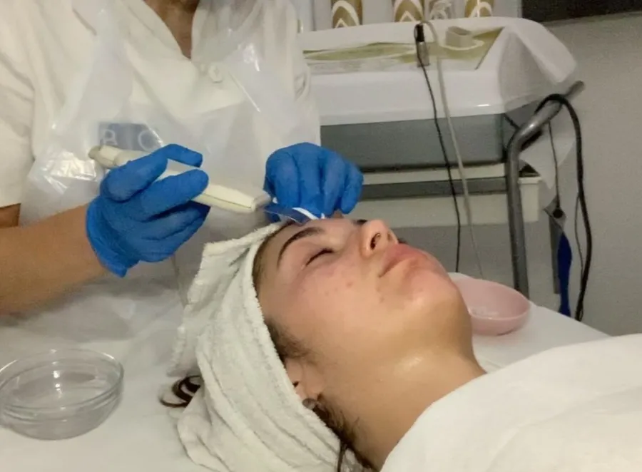 Pulizia viso ultrasonica: la spatola vibrante sulla fronte di una cliente distesa